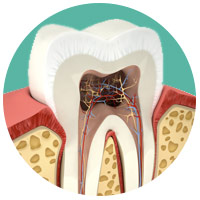 orlando dental services - root canal